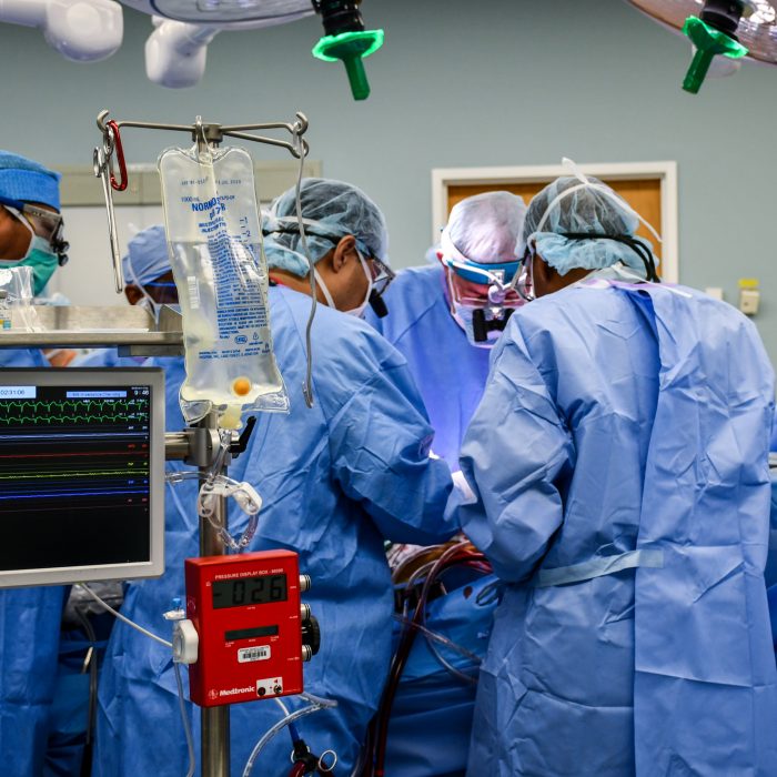 LVAD-3