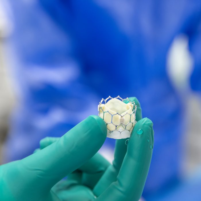 Heart valve surgery cardiology for patient in hospital. Prepare Transcatheter aortic valve implantation in doctor's hand.