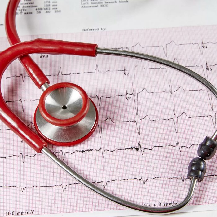 Stethoscope