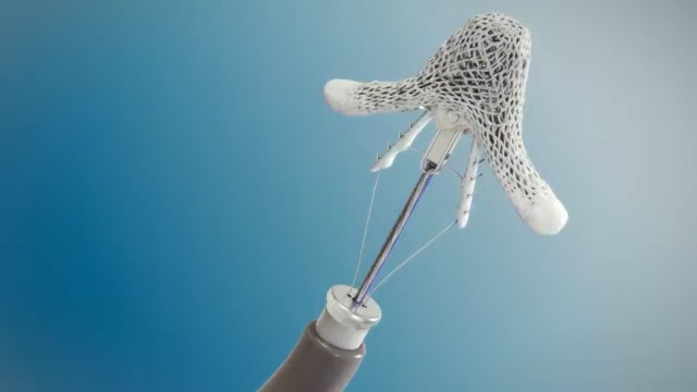 MitraClip